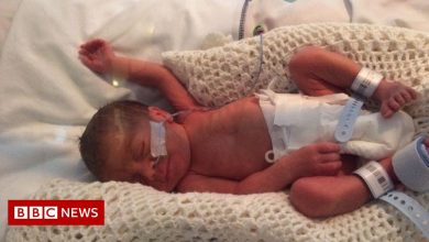Premature babies: Parents need more support for mental health