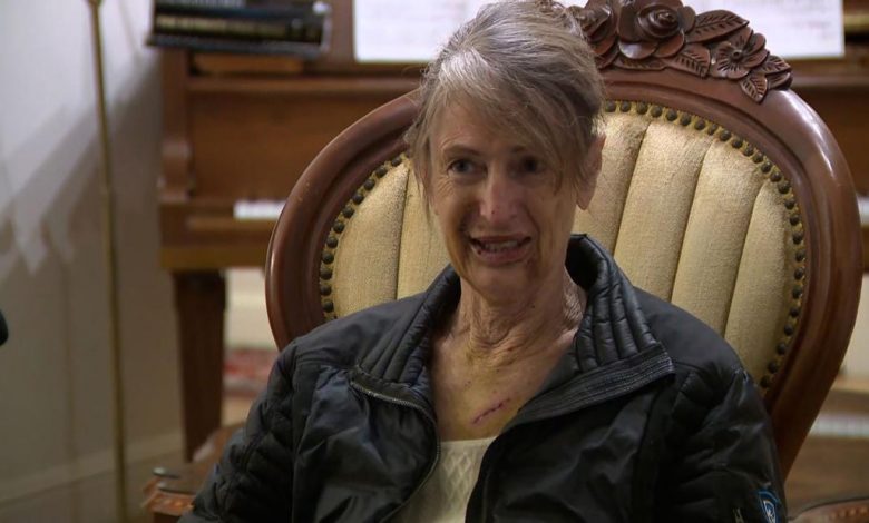 Woman battling cancer survives a bear attack in her Lake Tahoe cabin
