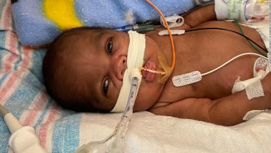 Baby born at 21 weeks becomes world's most premature baby to survive