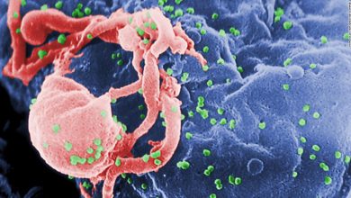 Second HIV patient may have been 'cured' of infection without treatment