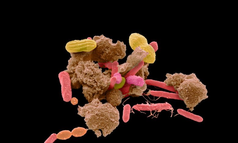 The role of the gut microbiota in autism gives Murkier