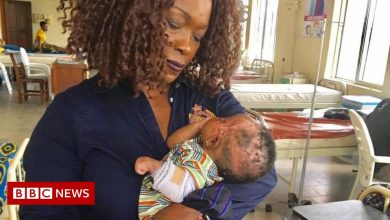 Nigerian woman's life changes when she visits a leper colony