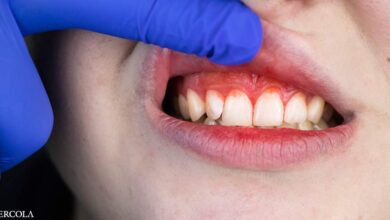 Gum disease increases the risk of mental health problems by 37%