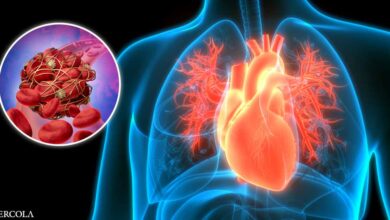 Blood Clots May Be the Root Cause of All Heart Disease
