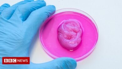 3D printing: Ears and nose created using human cells