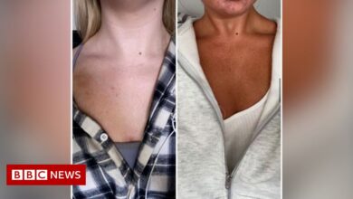 'Dangerous' tanning products promoted by influencers