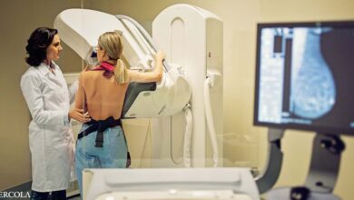 50% phụ nữ được chụp X-quang tuyến vú dương tính giả sau 10 năm