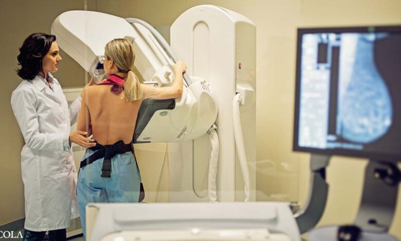 50% phụ nữ được chụp X-quang tuyến vú dương tính giả sau 10 năm