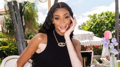 Winnie Harlow's Iris Apfel x H&M two-piece set will sell out