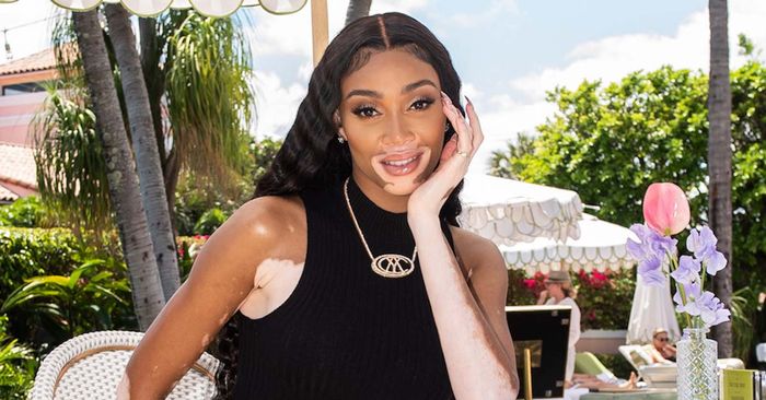 Winnie Harlow's Iris Apfel x H&M two-piece set will sell out