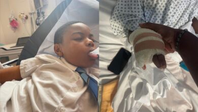 Boy forced to amputate finger after running away from racist bullies