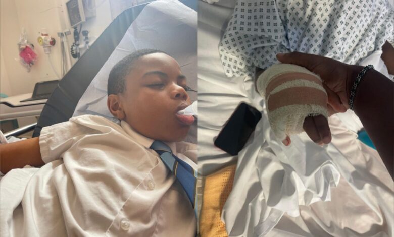 Boy forced to amputate finger after running away from racist bullies