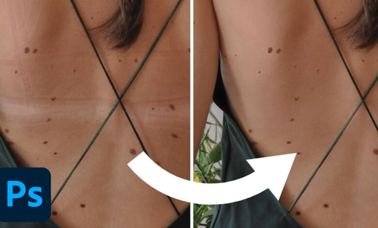 How to remove marks on skin with Photoshop
