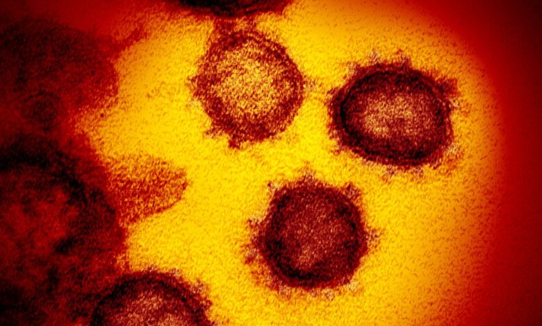 An undated transmission electron microscope image shows SARS-CoV-2, also known as novel coronavirus, the virus that causes COVID-19, isolated from a patient in the U.S., emerging from the surface of cells cultured in the lab. NIAID-RML/Handout via REUTERS. THIS IMAGE HAS BEEN SUPPLIED BY A THIRD PARTY. MANDATORY CREDIT