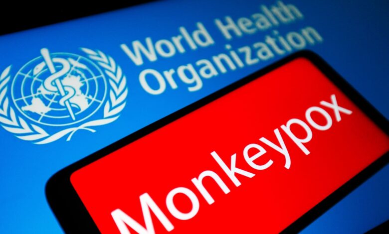 World Health Organization says monkeypox is not a global health emergency right now