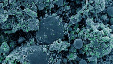 Colorized scanning electron micrograph of chronically infected and partially lysed cells (blue) infected with a variant strain of SARS-CoV-2 virus particles (green), isolated from a patient sample. Image credit: NIAID