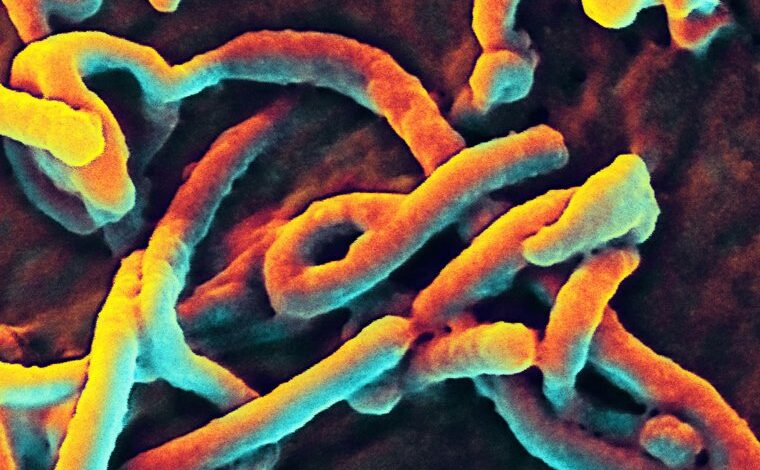 Ebola can be diagnosed quickly with new technology