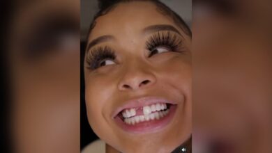 Chrisean Rock replaces her missing tooth and says she wants 'a space'