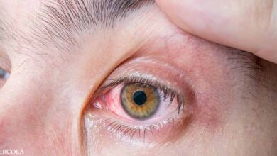 1 in 3 people have this eye parasite