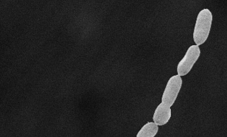 The largest bacteria ever discovered was the size of an eyelash: NPR