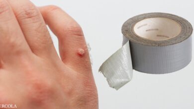 How to remove warts with duct tape