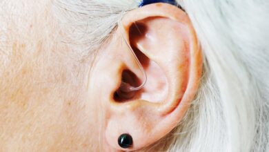 Unexpected consequences of OTC Hearing Aid