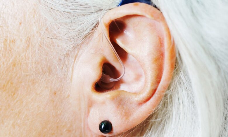 Unexpected consequences of OTC Hearing Aid