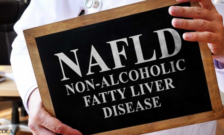 Can B vitamins help prevent alcoholic fatty liver disease?