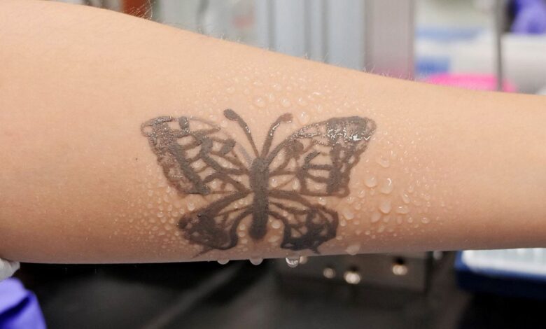 Korean researchers develop nanotechnology tattoos as health monitoring devices |  Science & Technology News