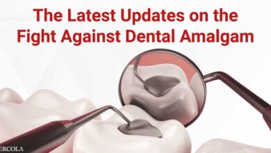 The latest updates on the fight against dental amalgamation