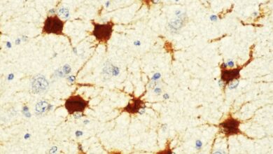 To understand brain disorders, consider astrocytes