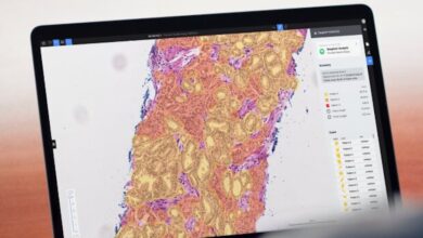 5 Korean hospitals try Deep Bio's AI-powered tool to diagnose prostate cancer