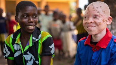 UN emphasizes 'Inclusion is power', marks Albinism Awareness Day