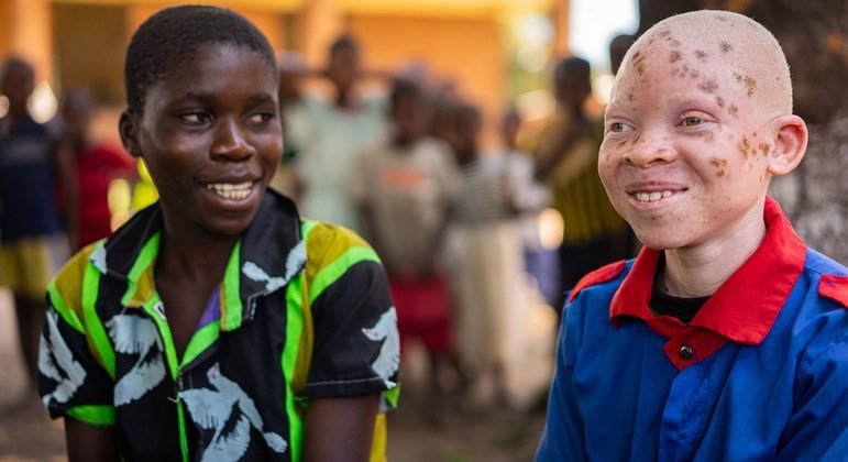 UN emphasizes 'Inclusion is power', marks Albinism Awareness Day