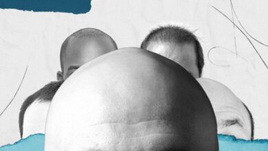 Male pattern baldness and the art of graceful balding