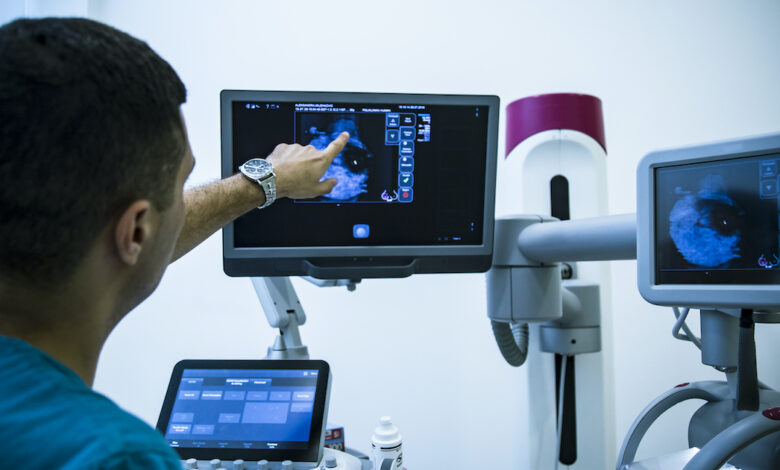 AI shows it can improve invasive breast cancer prediction