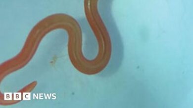 Live worm found in Australian woman's brain in world first