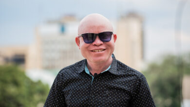 He's a singer, a cop and the inspiration for a Netflix film about albinism in Africa