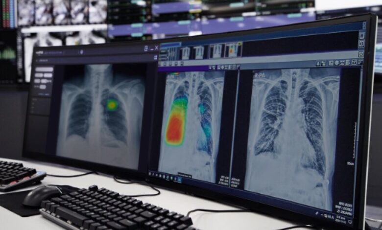 Growing adoption of AI CXR solution among APAC military hospitals and more briefs