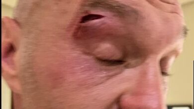 Tyson Fury-Oleksandr Usyk fight postponed after Fury suffers cut