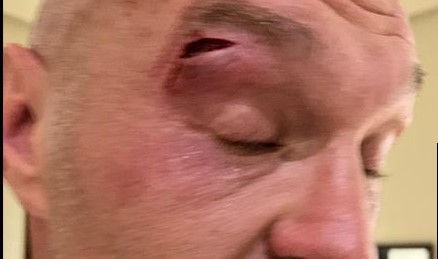 Tyson Fury-Oleksandr Usyk fight postponed after Fury suffers cut