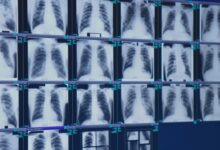 Finally, tough new safety rules have been introduced to prevent severe black lung: Snapshot