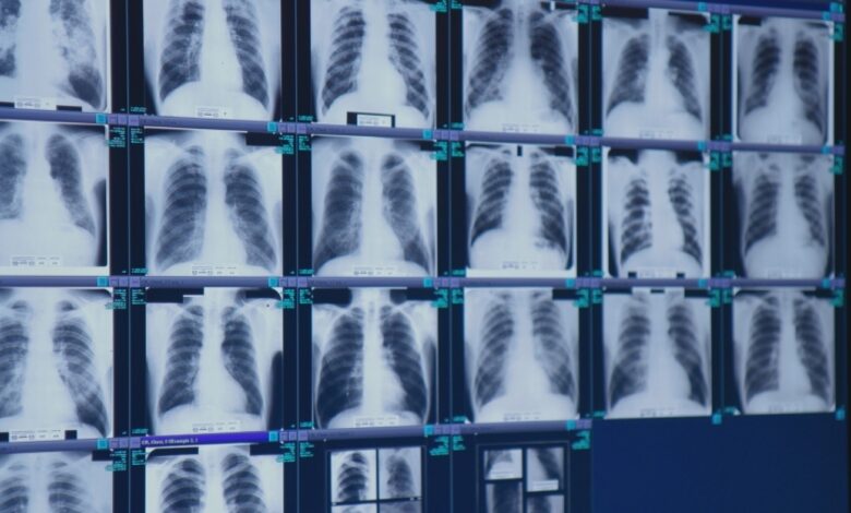 Finally, tough new safety rules have been introduced to prevent severe black lung: Snapshot