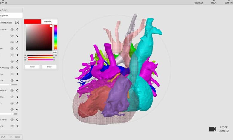 Rady Children's Launches Free 3D Image Viewer, Available to Other Providers